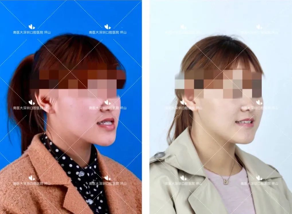 高考首日，深圳这家口腔医院笑着解出了最后“大题”：看牙难