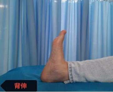 足踝骨折康复,足踝骨折康复训练视频