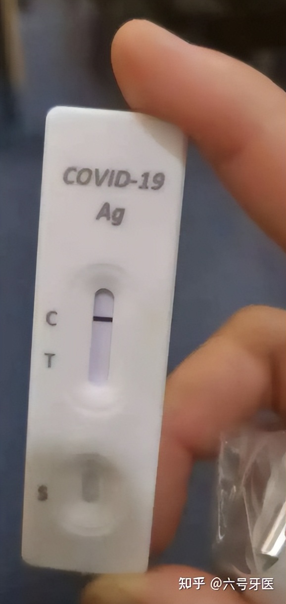 轻症新冠肺炎如何居家自我治疗？