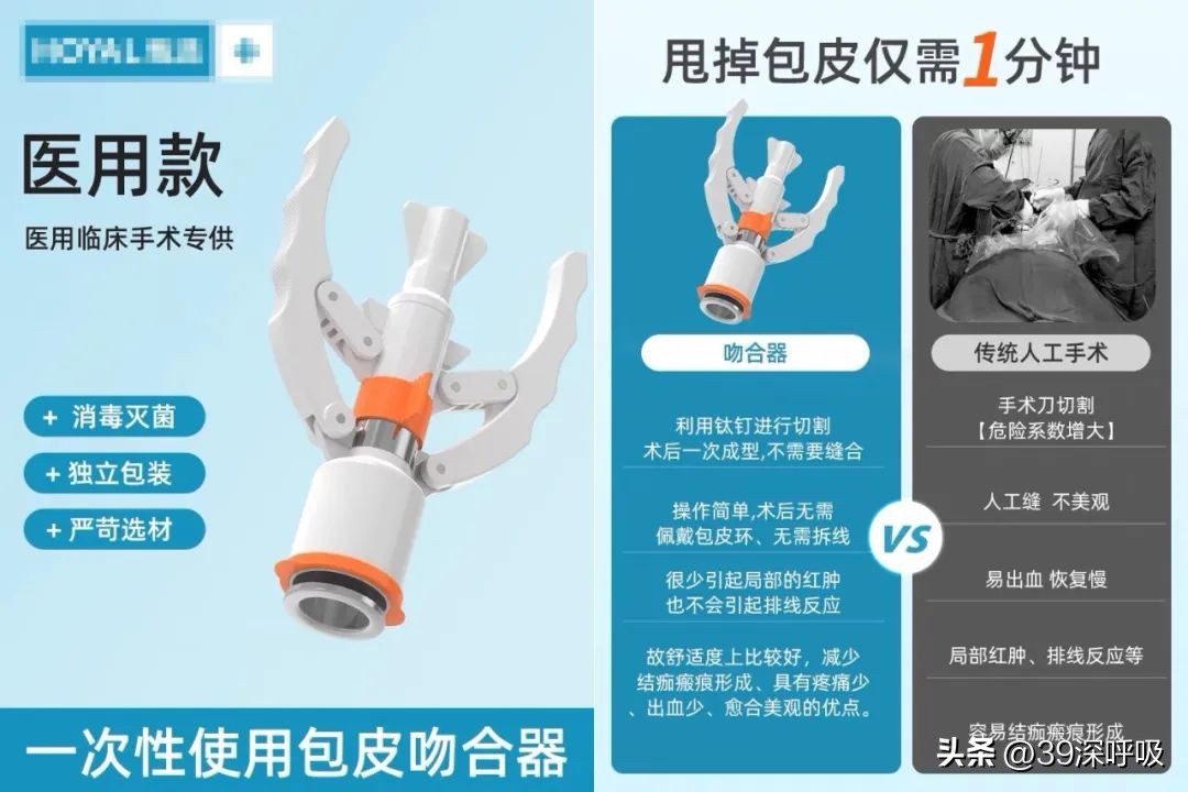 割过包皮的来说说感受和建议,割包皮已一年了还很难受怎么办呢