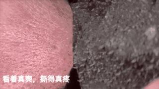 怎样才能彻底跟黑头说拜拜呢,科普如何让烦人的黑头消失