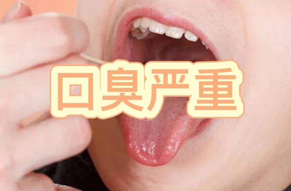 口腔喷雾杀菌除口臭持久留香测评,口臭哪个牌子的口腔喷雾好用