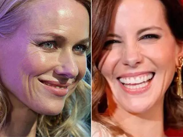 淡化法令纹逆龄抗衰,抗衰两个动作轻松淡化法令纹