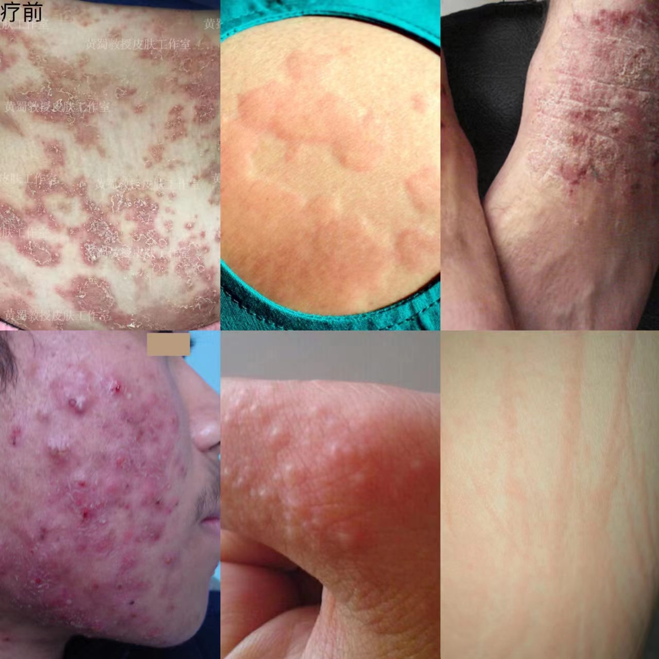 生活方式病是什么,生活方式治生活方式病干预方案