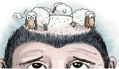 头顶秃植发多少钱,头顶轻微脱发植发多少钱