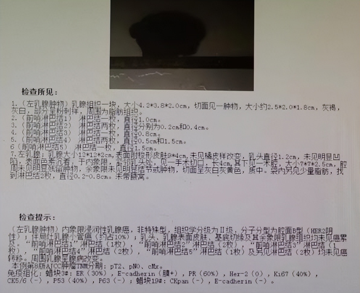 乳腺癌绝经后还需打卵巢抑制针吗,乳腺癌治疗结束后中药调理