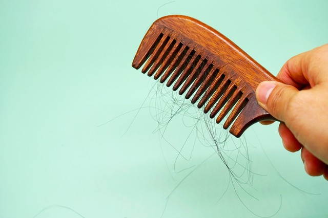 头发脱发有哪些偏方可以治,老是脱发怎么治疗最有效