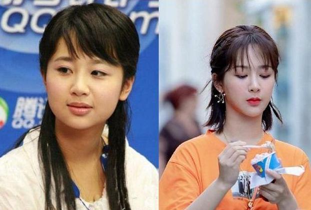 盘点整容失败惨不忍睹的30位女星,那些整容整失败的女明星