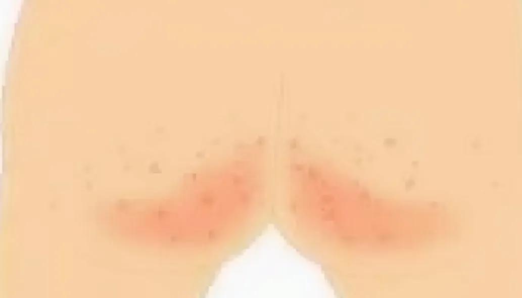 最好用的皮肤外用药,常用皮肤外用的药有哪些副作用