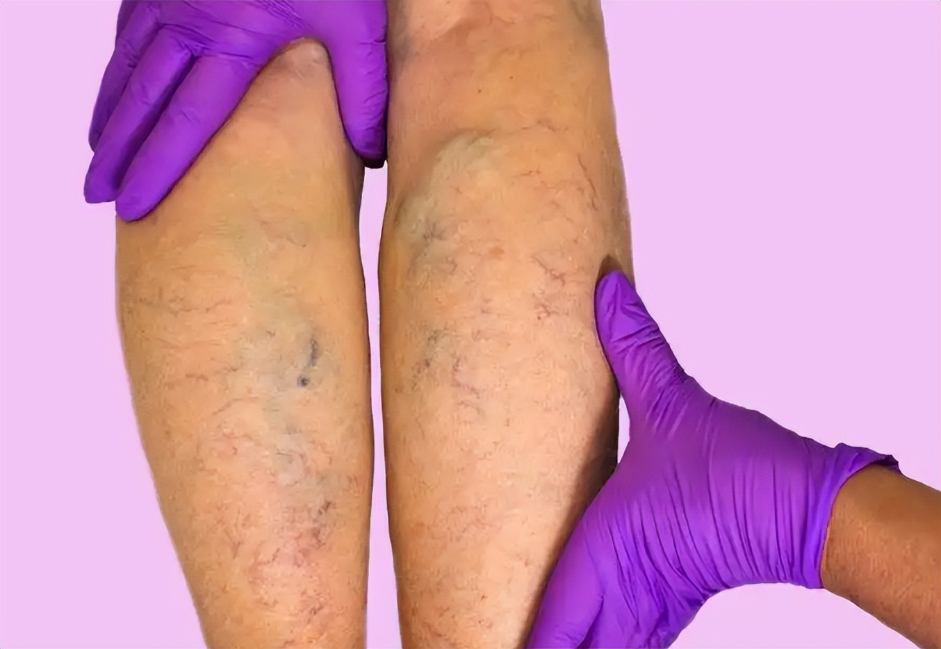 比疫情更可怕的危机来了，很多人却浑然不知，建议老百姓做好预防