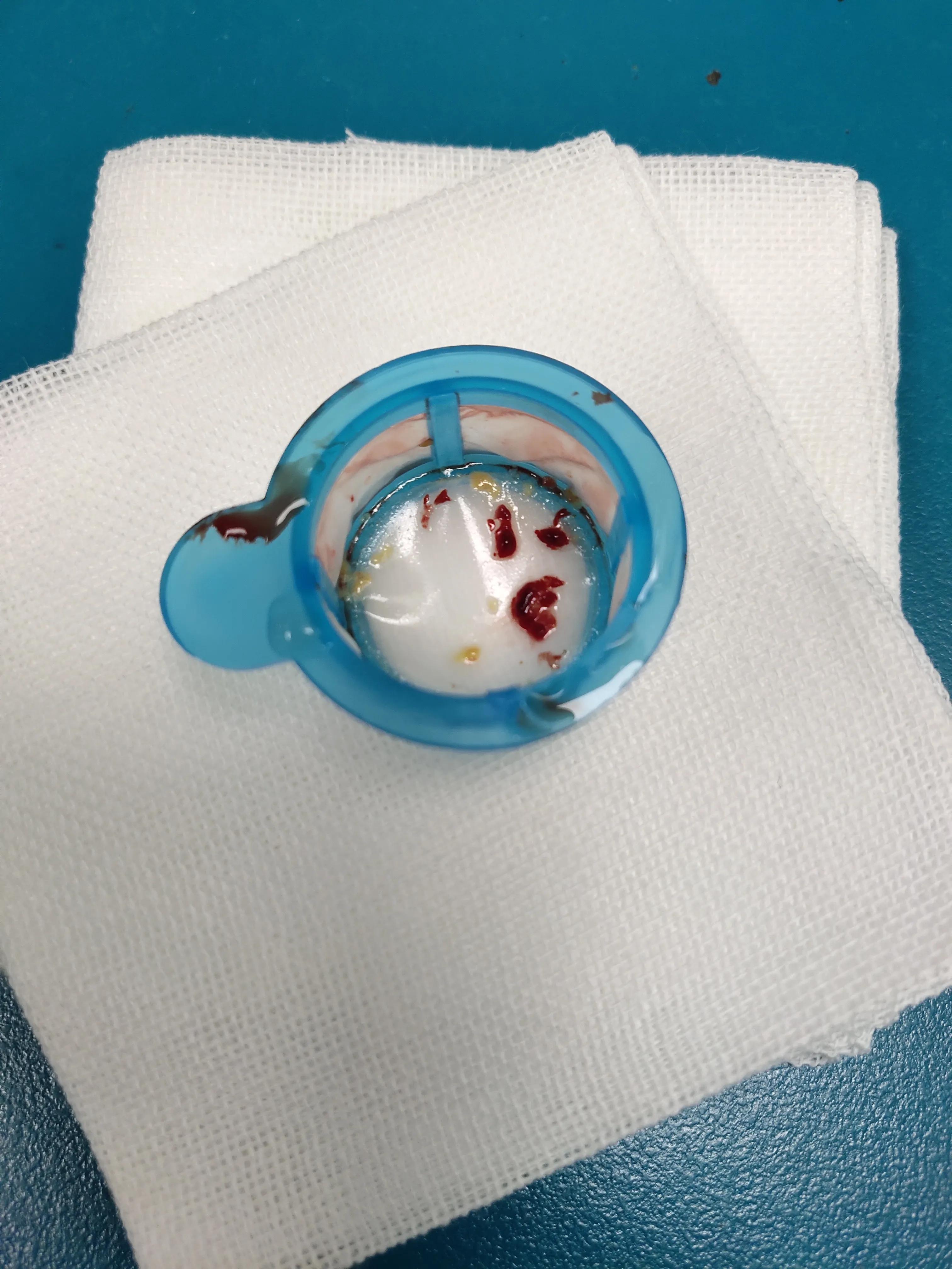 心脏支架后吃药胃不舒服吃什么药 (关于心脏病做了支架吃什么药)