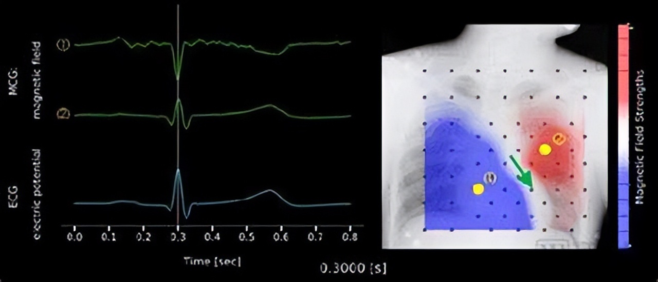 喝酒后心跳不规则是心脏病吗,喝酒导致心脏病