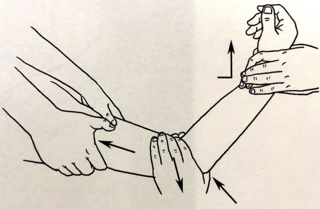 关节脱位的手法复位术操作步骤,关节脱位的手法复位