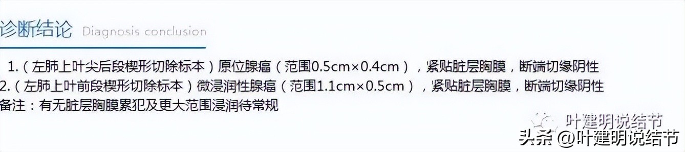 右下叶磨玻璃6mm结节基本上是癌,右下叶少许炎症上叶磨玻璃结节