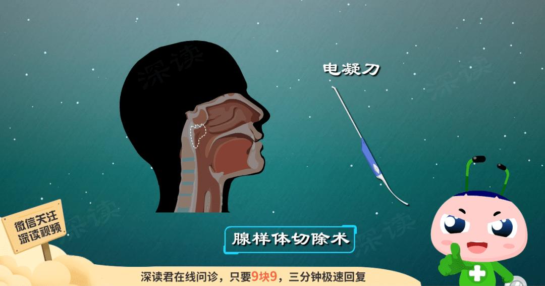 腺样体肥大打呼噜会变丑吗,三岁宝宝打呼噜是腺样体肥大吗