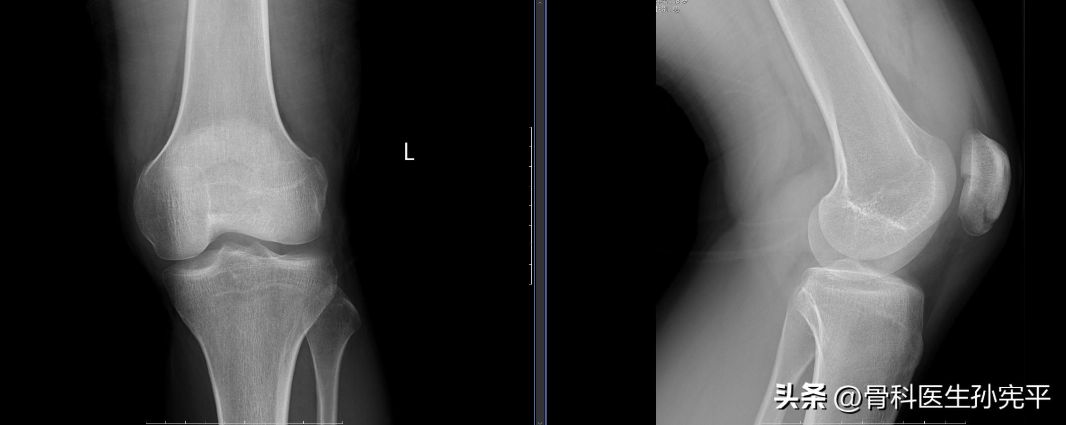 医学影像趣图,震撼的医学影像