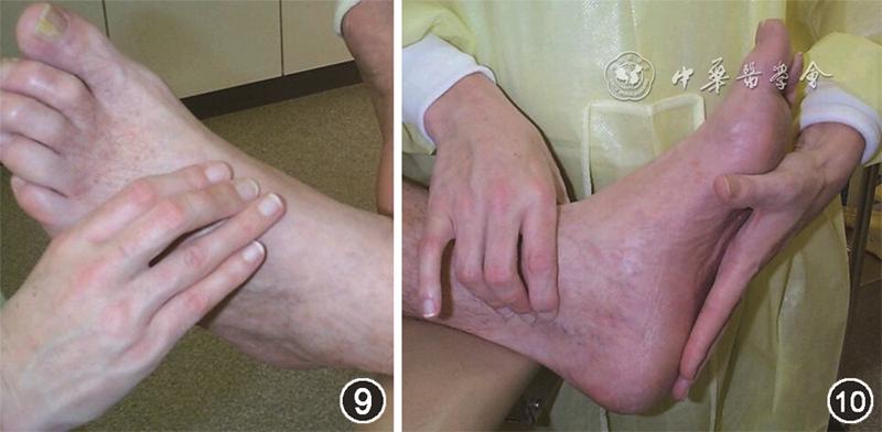 糖尿病病友自我管理手册,2022版ada糖尿病诊疗标准