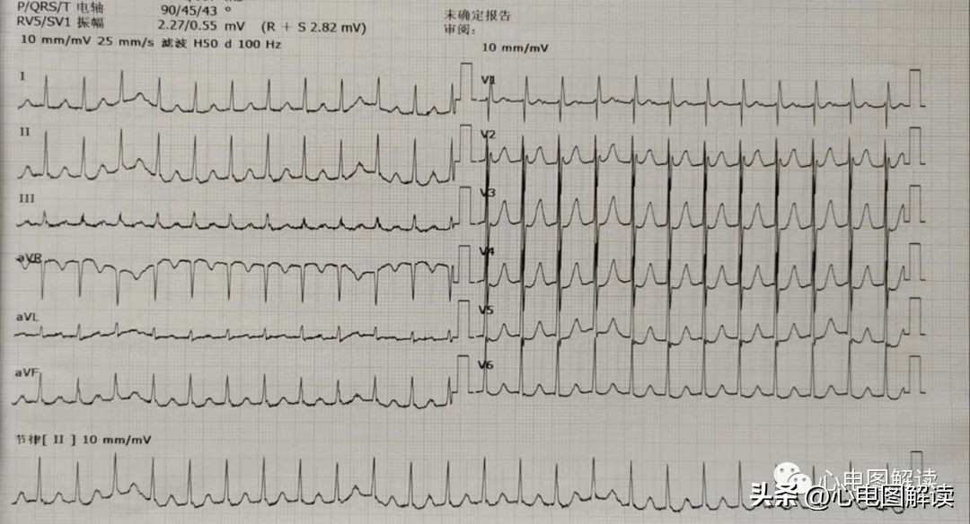 得来不易歌曲视频,得来不易纯音乐