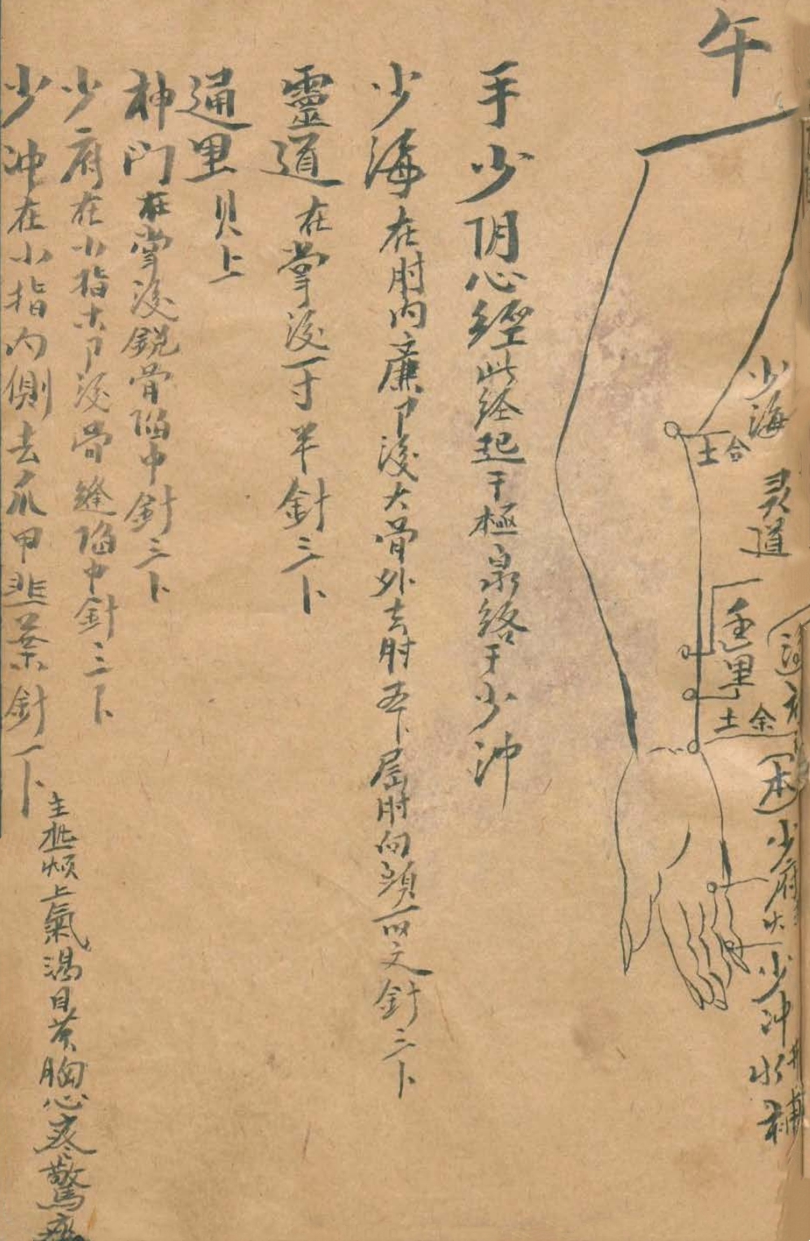 放痧疗法视频,放痧的最佳方法