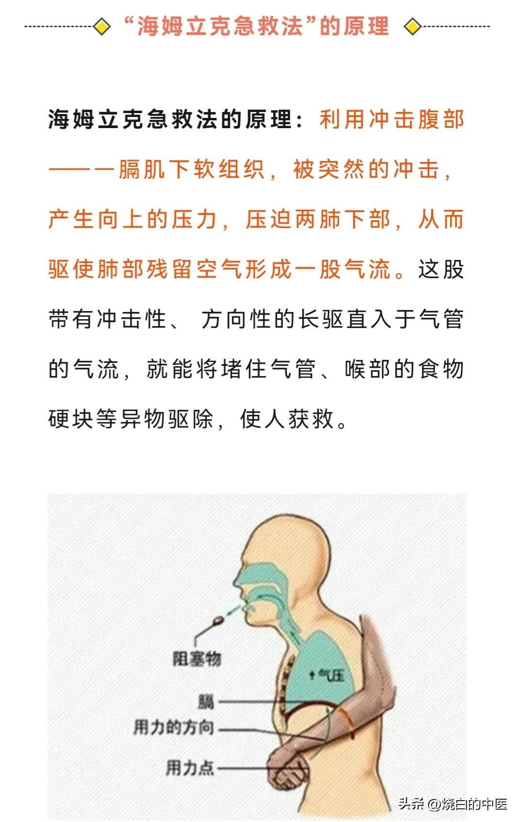 小儿高热惊厥处理方法有哪些,小儿高热惊厥正确处理方法