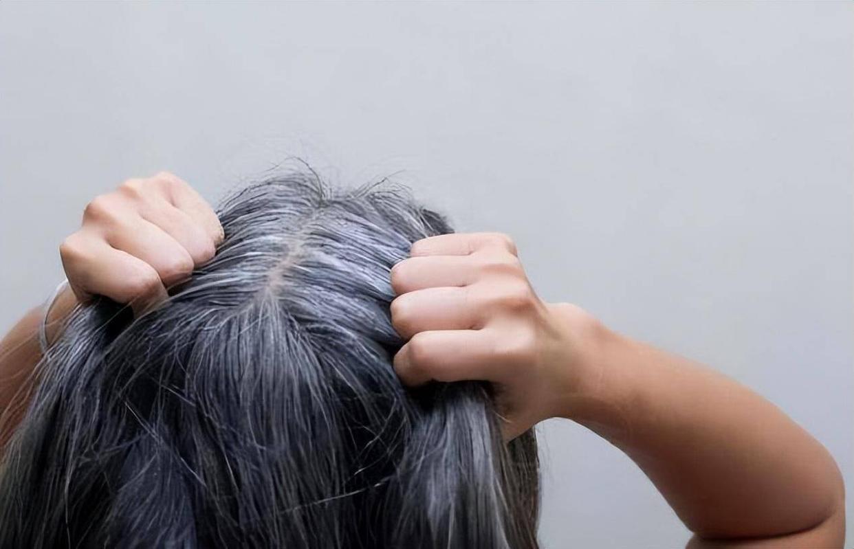 白发长在正头顶代表身体哪个器官,两鬓白发和后脑勺白发怎么治疗