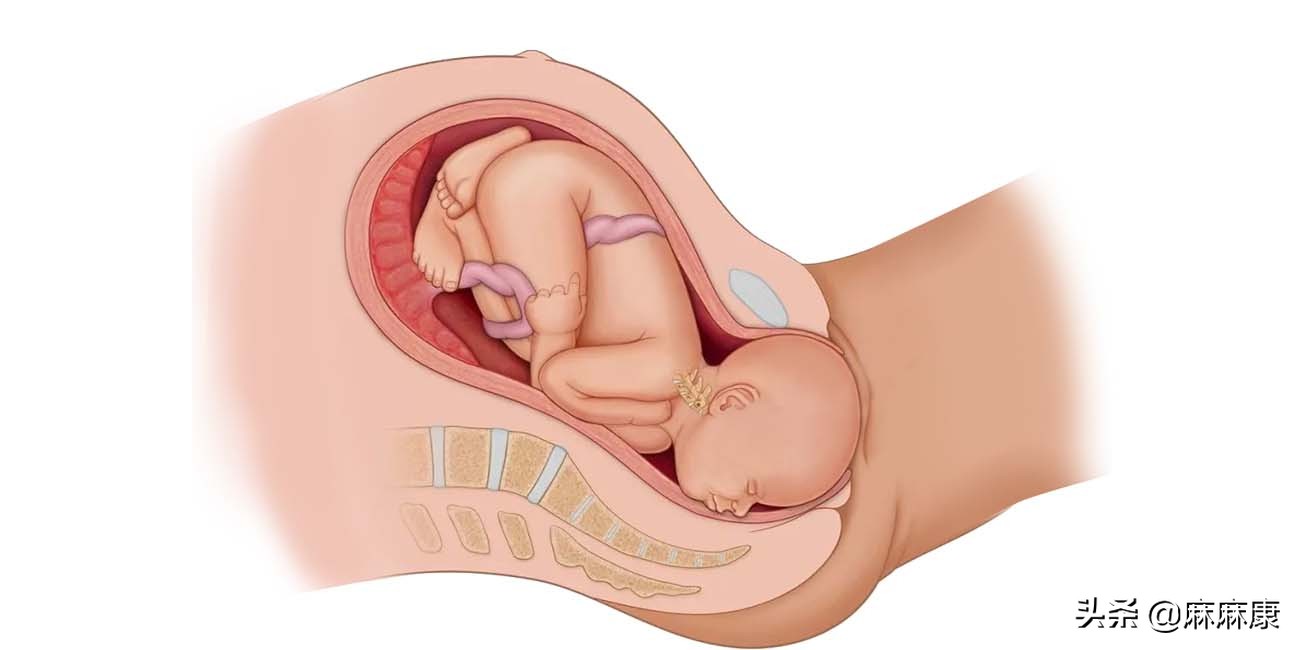 母牛产后排尿困难怎么回事,产后插尿管2次还是排尿困难