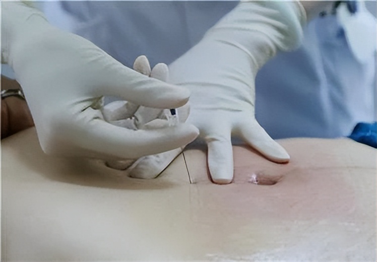 养生不养膘秋季减肥吃什么,秋天长膘如何减肥