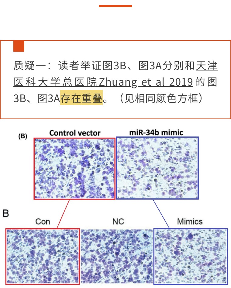 组图复制？浙江省桐庐县第一人民医院的论文被质疑抄袭