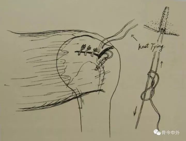 手把手教你绑滑漂,最简单的线结方法