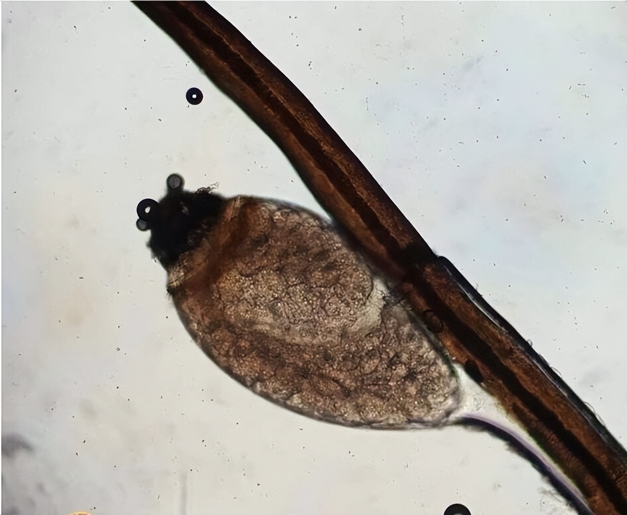 阴虱会传播性疾病吗,阴虱传播哪些疾病