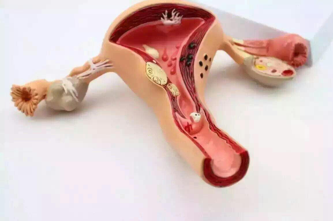 女性“同房”时，*处私**出现“灼热感”，怎么回事？妇科医生这样说