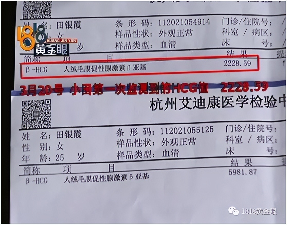 有没有hcg翻倍不好的保胎成功了,hcg几十不翻倍有保胎成功的吗