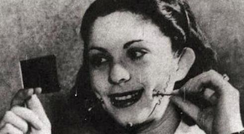 人造酒窝能维持几年,人造酒窝哪一种靠谱