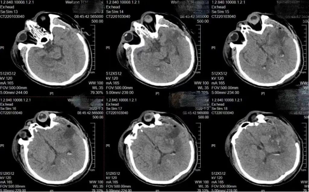 拼手速抢名额,拼手速收能量