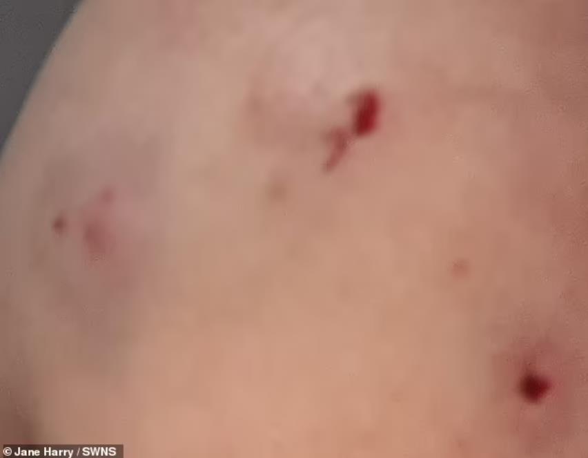 英国嗜血松鼠2天咬伤18人咬到出血!最终被抓起来安乐死