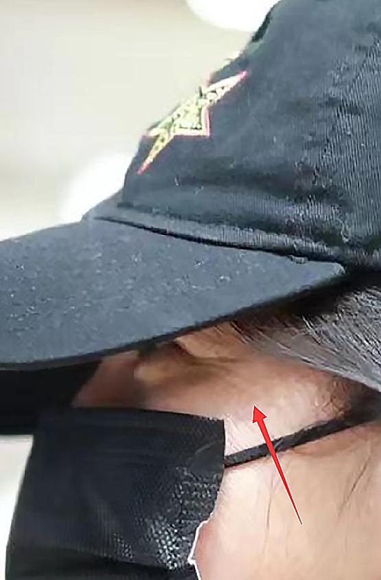 赵薇为啥显老,赵薇黑眼圈松弛