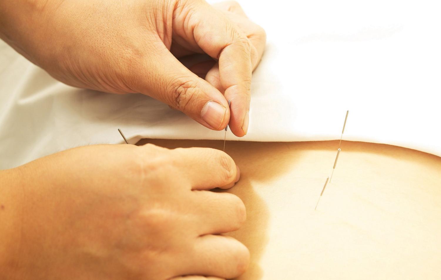 中医针灸治疗腰痛病的学术思想,古法针灸临床治验