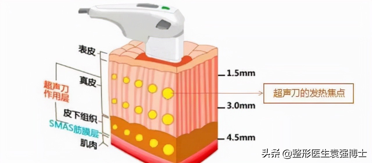 40岁面部皮肤松弛怎么紧致,40岁脸部松弛锻炼可以改善吗