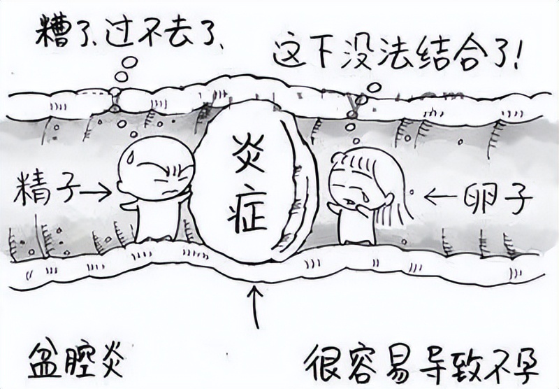 潜藏在不孕背后的“隐形杀手”？山东医生：都是盆腔炎惹的祸