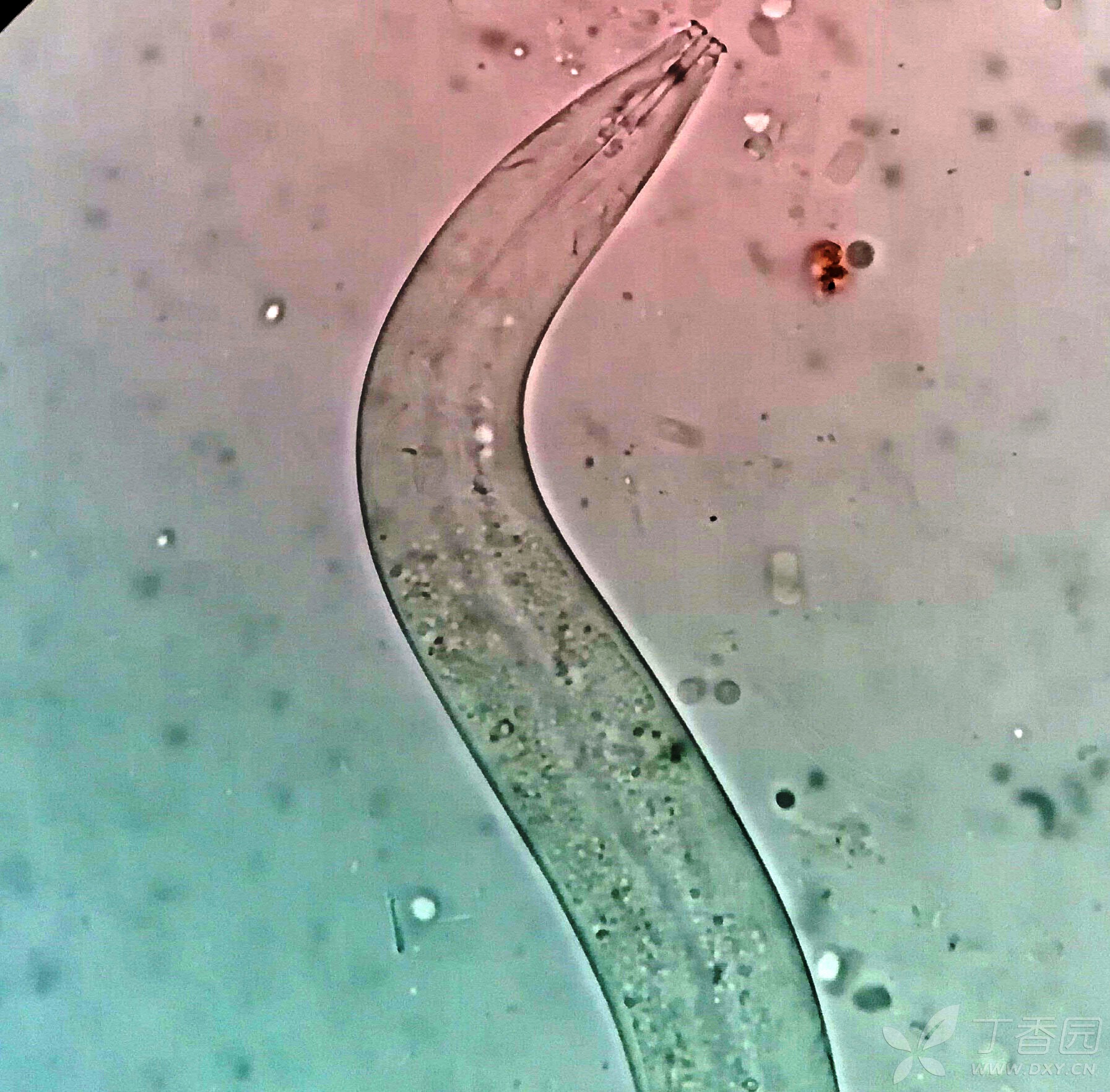 非洲大蜗牛入侵美国，每年可产5窝，花费数百万美元没法治理