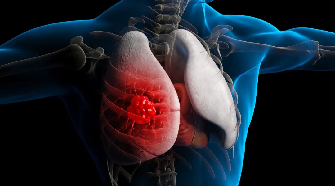 转录因子突变导致的疾病,转录因子对基因活性的影响