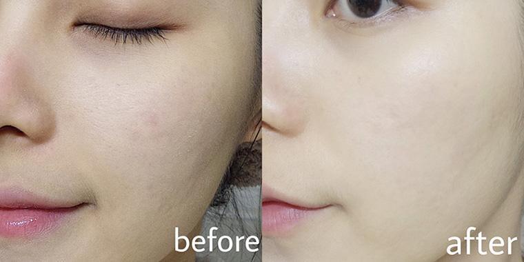 百雀羚肌初赋活紧肤精华水90ml,35岁以上哪一款精华水好用