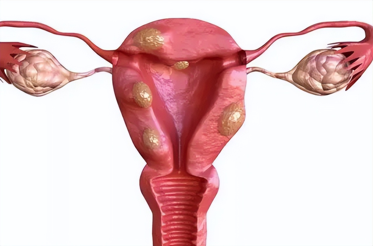 绝经了该注意些什么,绝经了要注意些什么