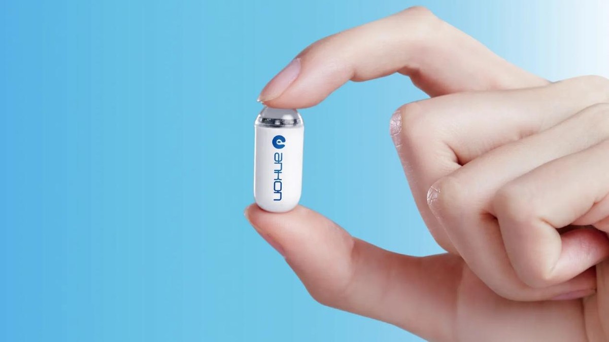 安翰科技胶囊胃镜,安翰磁控胃镜的缺点