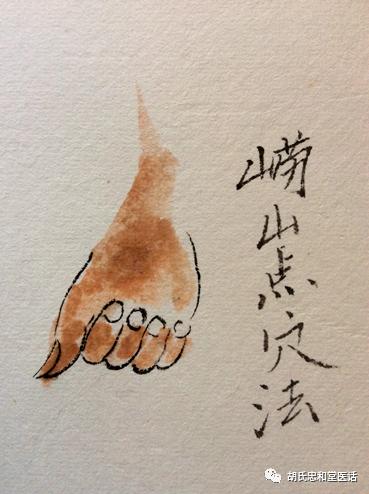 针灸中的针与灸的区别,针灸穴位与按穴位有什么区别