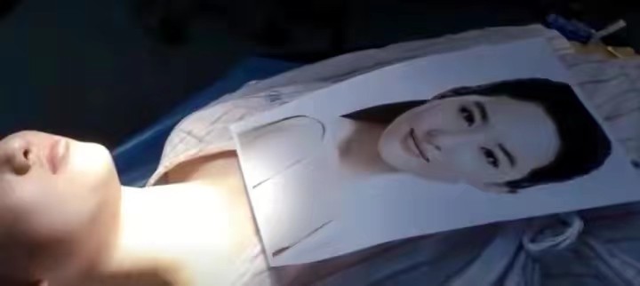 整容成刘亦菲有多难,6年前整容女星