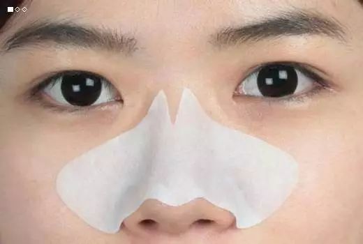 去鼻子黑头粉刺的过程,镊子去除鼻子上的黑头