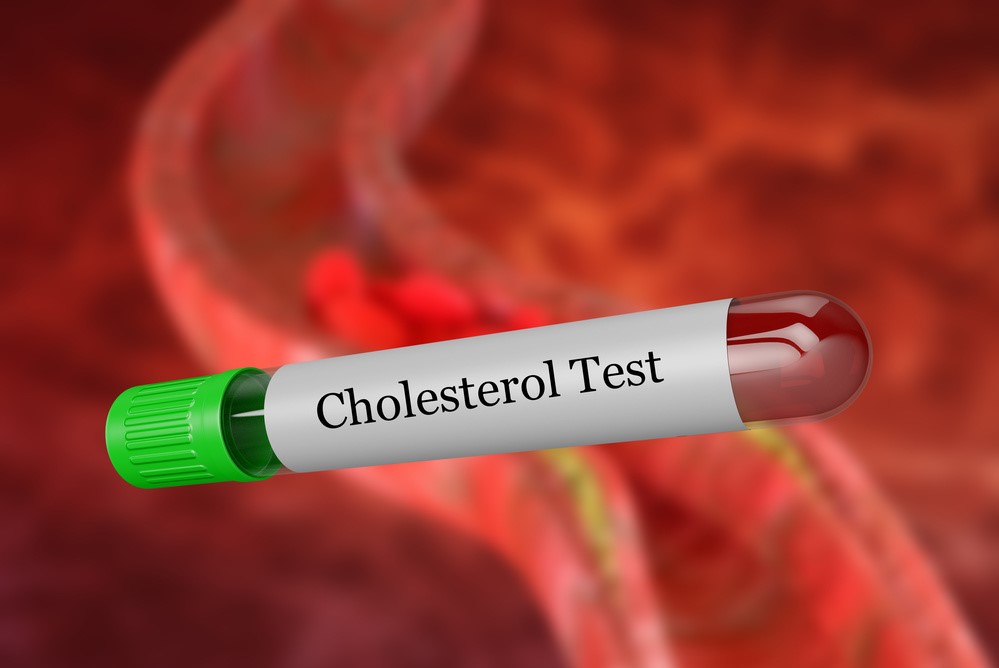 普通鱼油和降血脂鱼油一样吗,鱼油有降血脂软化血管的作用吗