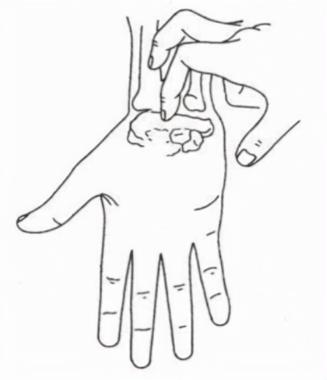 鼠标手手指麻木,鼠标手麻木无力