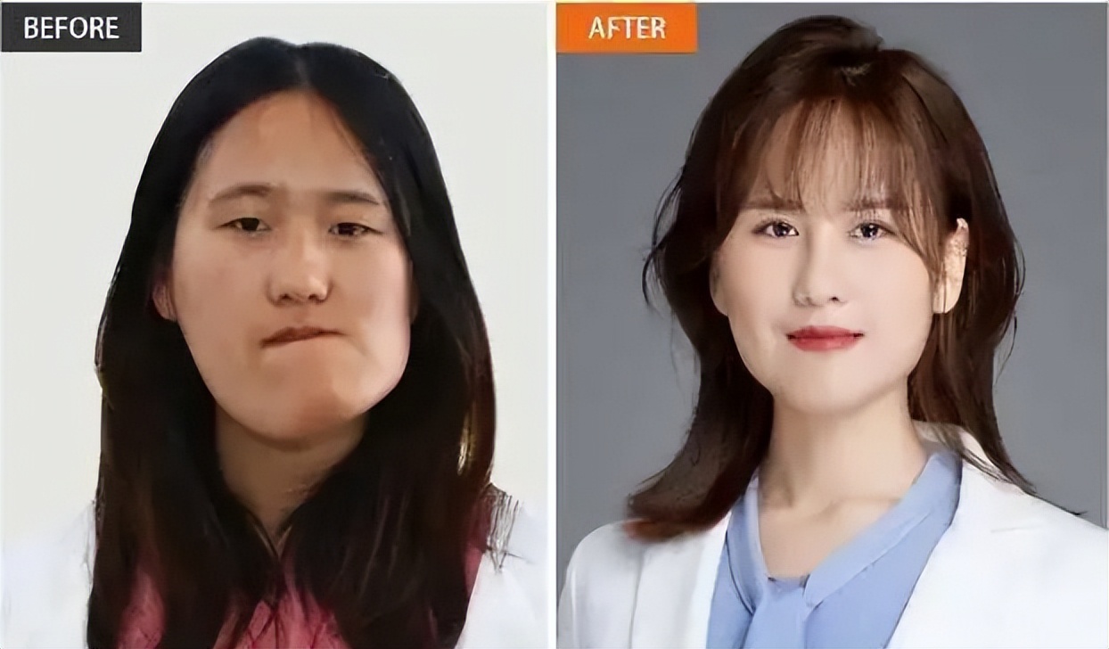 辽宁歪脸女孩，父母双亡，她整容变美女，拒百万年薪，只想当老师